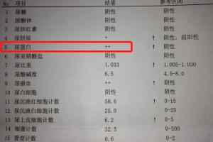 2022年深圳市积分入户体检费